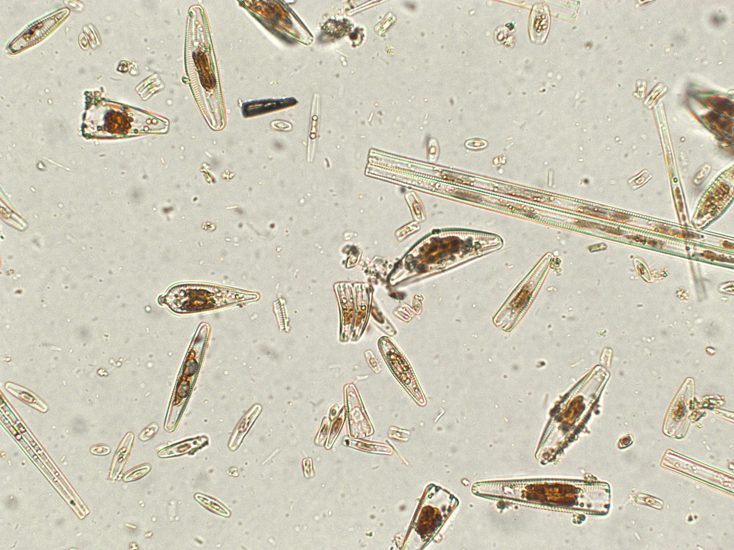 Filtro de terra diatomacea